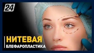 Нитевая блефаропластика. Стоит ли она своих денег?