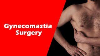 Gynecomastia surgery result