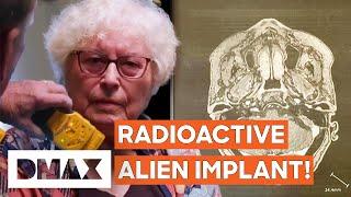 Radioactive Alien Implants Discovered Inside Woman Confirms UFO Encounter | UFO Witness