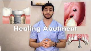 Healing Abutment