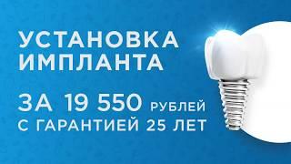 Имплантация зубов от 19 550 ₽ в Перми!