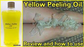 Yellow Peeling Oil Review | How to use and before and after skin peeling