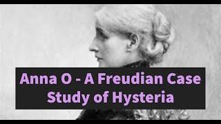 Anna O - A Freudian case study of Hysteria and the Electra Complex