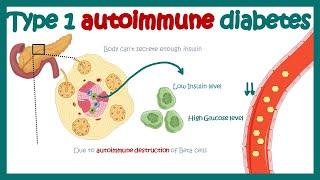 Type 1 diabetes (autoimmune diabetes) | cause and consequences