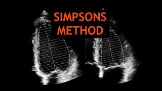 Simpsons Method: Echocardiography