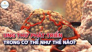 Ung thư phát triển trong cơ thể như thế nào?| BS Phan Trúc, BV Vinmec Times City