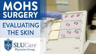 How skin is Processed and Evaluated During Mohs Surgery