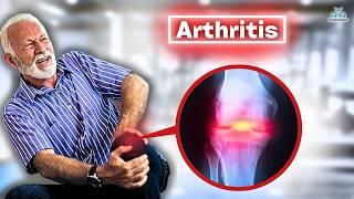 The BEST Knee Osteoarthritis Rehab Exercises!