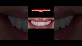 Dental Health Care  | Dr. Wasif Rashid | Dentist | #foryou #shorts
