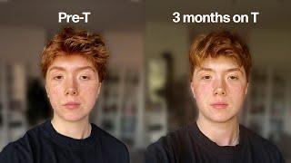 I documented every change my first 3 months on testosterone