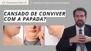 A papada te incomoda? Lipo de papada, liftimg cervical e deep-neck. Conheça os tratamemtos usados.