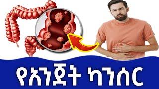 የአንጀት ካንሰር በሽታ (colon cancer) የሚከሰትበት ምክንያቶች ፣ ምልክቶቹ ፣ አጋላጭ ሁኔታዎች እና ህክምናዎቹ