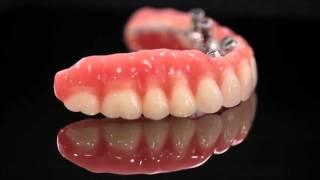 K Dental Lab Implant 2