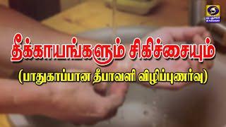 தீக்காயங்களும் சிகிச்சையும் (பாதுகாப்பான தீபாவளி விழிப்புணர்வு) | 29.10.2024