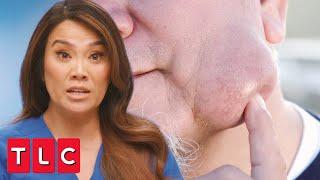 “Like a Water Balloon Filled With Oatmeal” | Dr. Pimple Popper