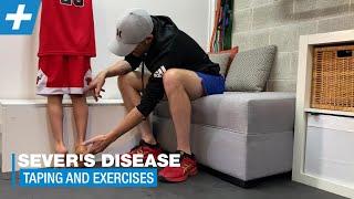 Help for Sever's Disease (heel pain) in Kids | Tim Keeley | Physio REHAB