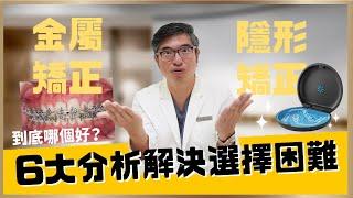 隱適美牙齒矯正是什麼？到底該選金屬矯正還是隱形矯正好？從6大面向分析來解決你的牙齒矯正選擇障礙｜【祐民牙醫－隱適美旗艦店】鑽石級楊大為醫師 #隱適美   #隱形矯正 #隱形牙套 #牙齒矯正 #矯正牙齒