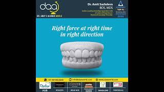 Invisalign Treated by Dr Amit Sachdeva