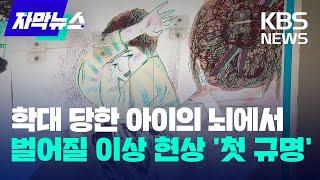 [자막뉴스] 학대 당한 아이의 뇌에서 벌어질 이상 현상 '첫 규명' / KBS 2023.08.02.