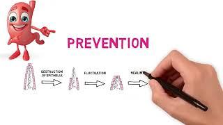 Heartburn treatment Ulsanic (Sucralfate) Mode of Action & Gastric protection, prevention and healing