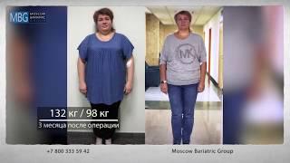 До и после бариатрической операции. Пациенты клиники Moscow Bariatric Group.