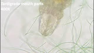 MY JOURNEY to the MICROCOSMOS - Ep.6