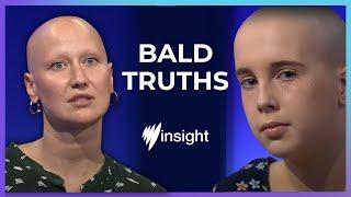 From full hair to bald in 6 months | SBS Insight