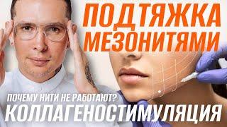 Подтяжка лица Мезонитями | Почему НИТИ не работают? КОЛЛАГЕНОСТИМУЛЯЦИЯ нитями #мезонити