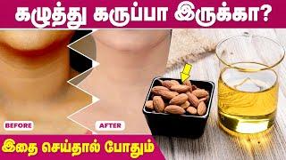 Neck Blackness Remove Tips | Dark Neck | IBC Mangai