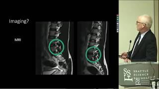 Spondylolysis & Spondylolisthesis - Wally Krengel, M.D.