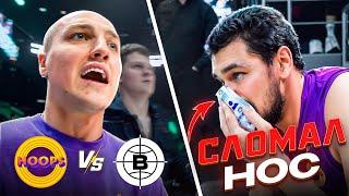 HOOPS vs BLATOSPHERA / ИГРОКУ СЛОМАЛИ НОС !