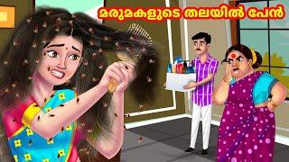 മരുമകളുടെ തലയിൽ പേൻ | Malayalam Stories | Moral Stories in Malayalam | Anamika TV Malayalam