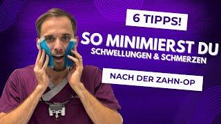 So reduzierst du Schwellungen und Schmerzen nach Zahn OPs und Implantationen!
