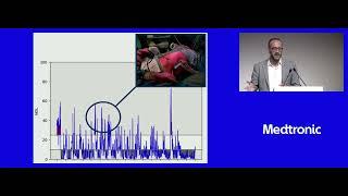 Implementing NOL monitoring in Clinical Practice