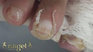 LIMPEZA SATISFATÓRIA EM TODOS OS DEDOS NOS PÉS #satisfying #nails
