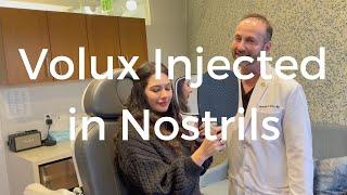 Los Angeles Volux Filler Injections For Nostrils | RIVKIN Aesthetics: Dr. Alexander Rivkin