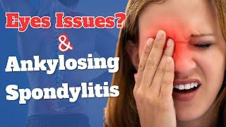 How is Ankylosing Spondylitis Affecting the Eyes?