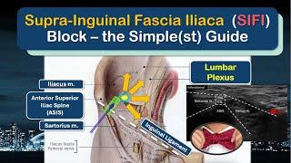 Fascia Iliaca Block - a Definitive "How-To" Guide [2025]