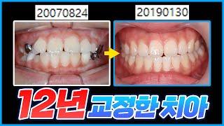 교정 끝내고 보니 강산이 바뀌었음..