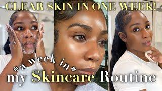 DO THIS EVERYDAY FOR CLEAR, GLOWY SKIN! | WEEKLY SKINCARE ROUTINE FOR ACNE, DARK SPOTS + GLASS SKIN