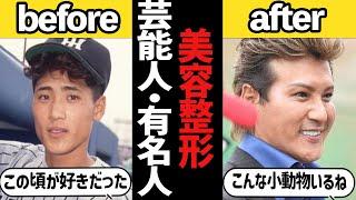 【ガルちゃん】あ、また変わった。美容整形していると思う有名人・芸能人教えて【有益2ch】
