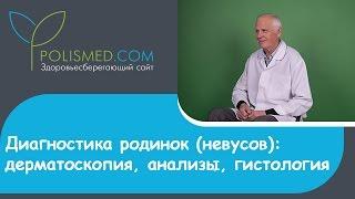 Диагностика родинок (невусов): дерматоскопия, анализы, гистология