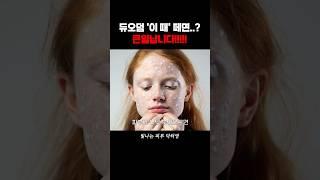 듀오덤 올바른 사용법 꼭 알고가세요!! #듀오덤 #기미잡티