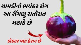 ચામડીનો ભયંકર રોગ - આ રીંગણું રાતોરાત મટાડે છે