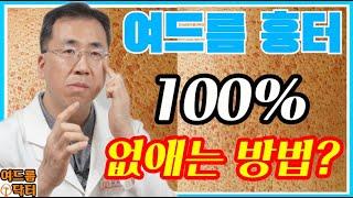 여드름 흉터100% 없애는 방법 #여드름흉터 #여드름흉터없애는방법 #여드름흉터없애는법 #여드름자국