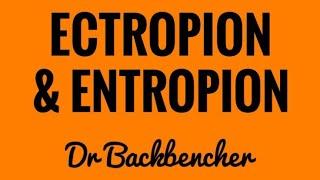 Ectropion and Entropion - causes, symptoms, types and treatment - Ophthalmology