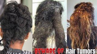 Must Watch️Extremely Dry Matted Clumps Of Hair  | Formation & Removal Process