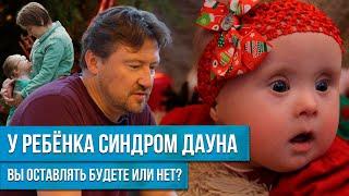 УНИКАЛЬНЫЙ СЛУЧАЙ! РОДИТЕЛИ ИЗ РЕБЕНКА С СИНДРОМОМ ДАУНА ВЫРАСТИЛИ МАЛЕНЬКОГО ГЕНИЯ