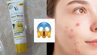 Yc lemon face wash review | Areej Fatima | #facewash #review #skincare #areejfatima