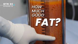 How Much FAT is Used During a BBL? | BTM5 Ep.19 #bbl #drwilliam